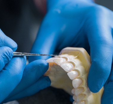 A dental lab technician creating teeth for dentures